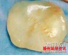 <b>女婴带玉出生 贾宝玉投胎？真相竟然是？？</b>