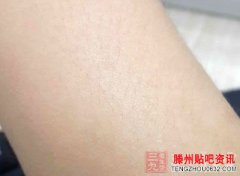 <b>出汗的好处5大因素让你比别人易出汗</b>