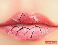 秋季如何预防嘴唇干裂?日常护理唇部要注意这几