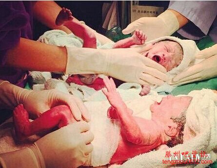 三胞胎有三个爹