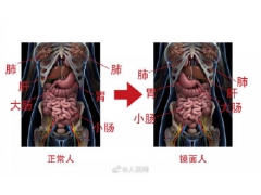 罕见！一女子五脏六腑全部反着长