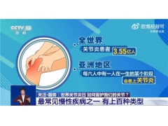 中国关节炎患者超过 1 亿人